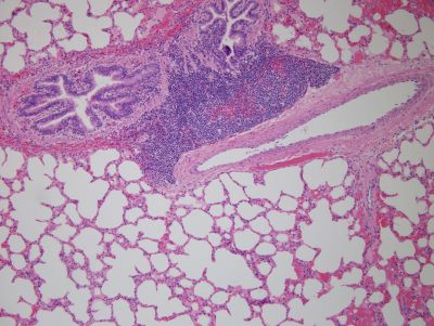 mycoplasma under the microscope showing pink and purple